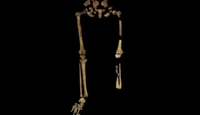 Minden eddiginél régebbi amputációra találtak bizonyítékot a régészek Indonéziában