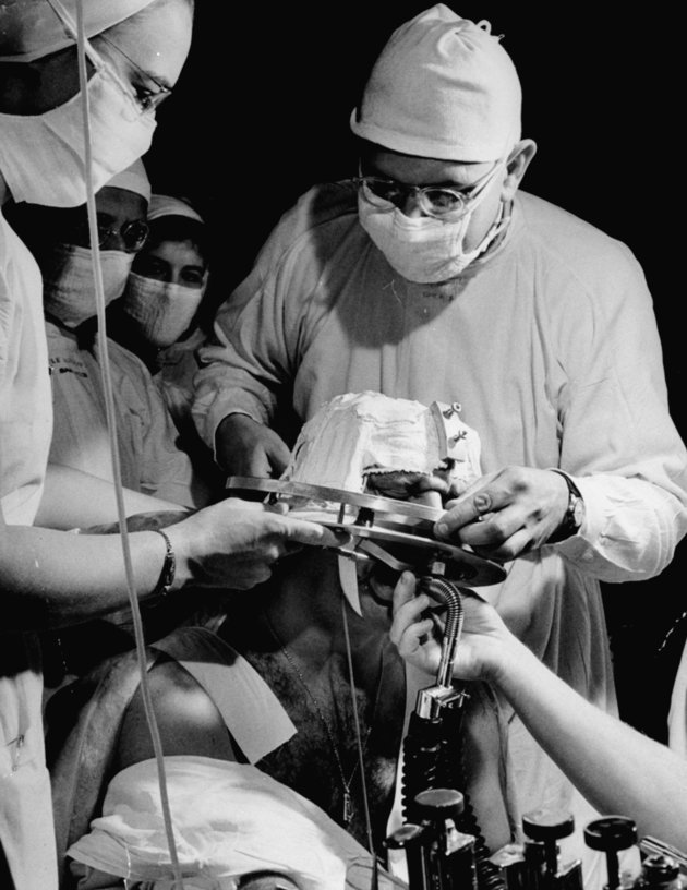 Agyműtétre készülő orvosok a 20. század második felében