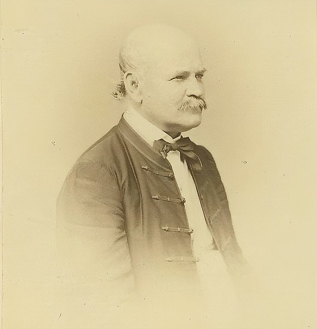Semmelwis Ignác 1860-ban