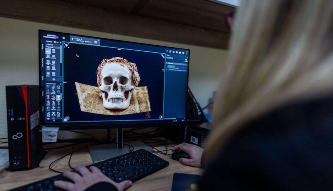 Először vizsgáltak római kori múmiát CT-vel Magyarországon