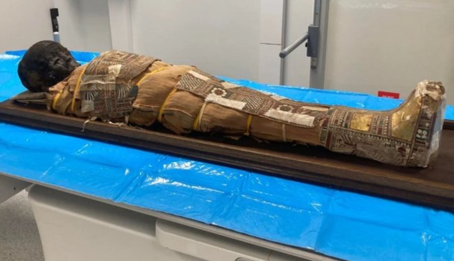 Száz éve őrzött gyermekmúmia titkai tárulnak fel CT-vizsgálatokkal